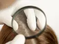 Wie viele Haare hat der Mensch? Die überraschende Antwort