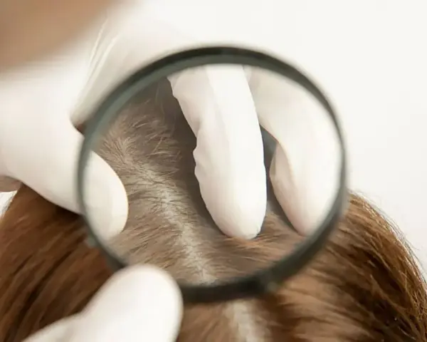 Wie viele Haare hat der Mensch? Die überraschende Antwort