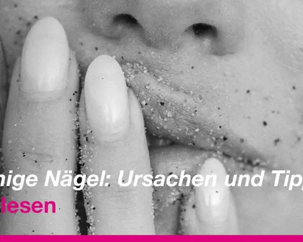 Brüchige Nägel? So stoppen Sie das Splittern Expertentipps