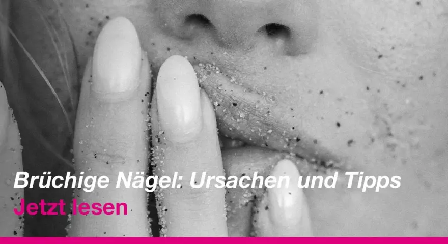 Brüchige Nägel? So stoppen Sie das Splittern Expertentipps